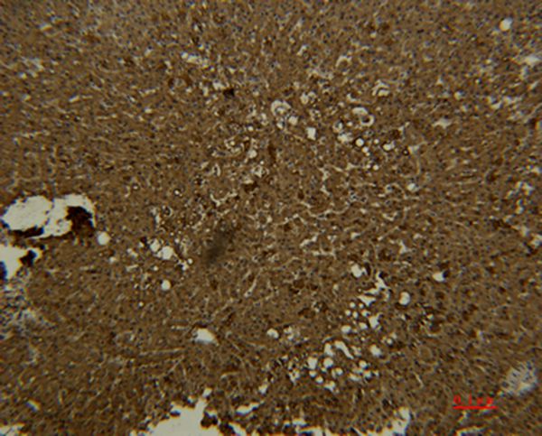 Transferrin Monoclonal Antibody(7H11)