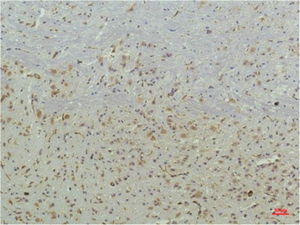 PPAR Delta Mouse Monoclonal Antibody(2F9)