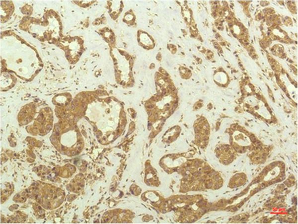 P70 S6 Kinase Mouse Monoclonal Antibody(1C7)