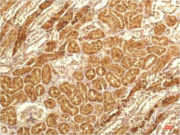 IL-8 Mouse Monoclonal Antibody(14E1)