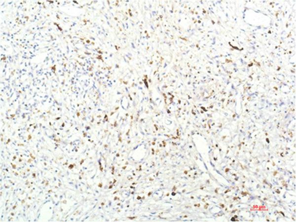 JAK1 Mouse Monoclonal Antibody(7G6)