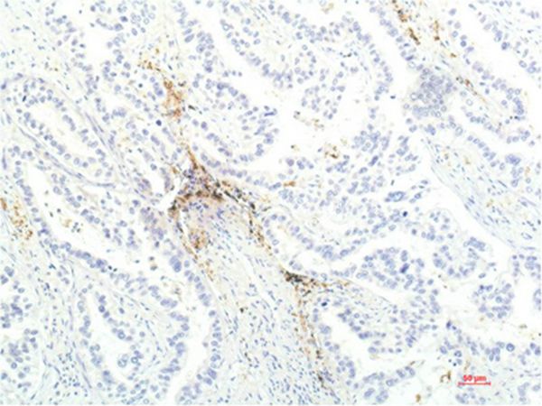 JAK1 Mouse Monoclonal Antibody(7G6)