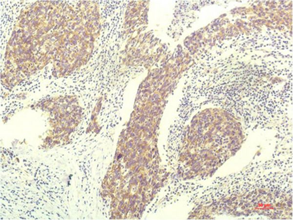 STAT1 Mouse Monoclonal Antibody(12E8)