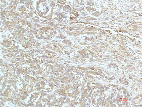 a-actinin Monoclonal Antibody(4A12)