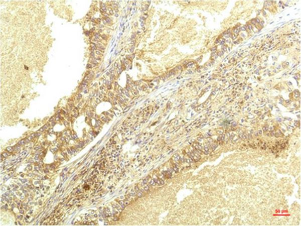 IL-8 Mouse Monoclonal Antibody(8B1)