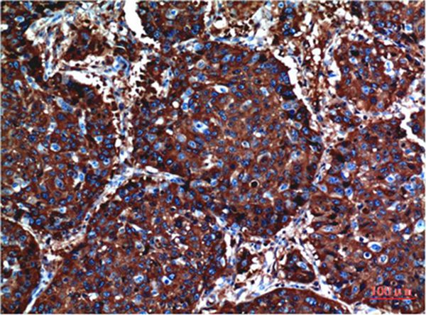 AKT Mouse Monoclonal Antibody(10D6)