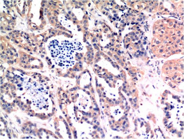 Bax Mouse Monoclonal Antibody(6F11)