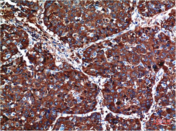 AKT Mouse Monoclonal Antibody(1H2)