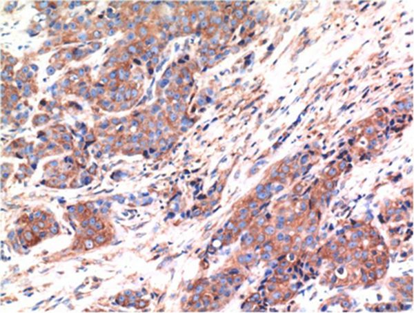 Bax Mouse Monoclonal Antibody(1C1)