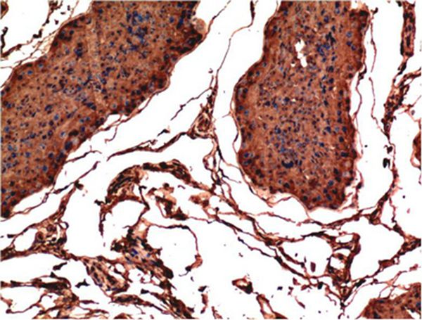 Bax Mouse Monoclonal Antibody(1C1)