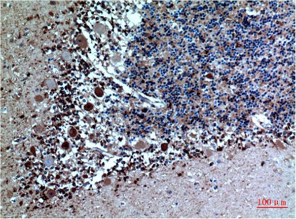 Cystatin C Mouse Monoclonal Antibody(5A2)