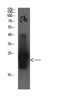 Cystatin C Mouse Monoclonal Antibody(5A2)