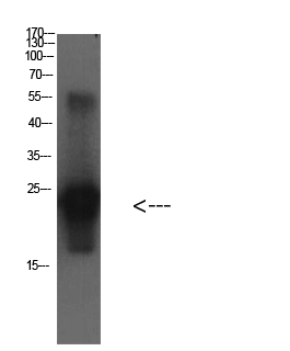 Cystatin C Mouse Monoclonal Antibody(3B12)