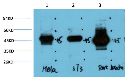 GSK3β Mouse Monoclonal Antibody(1A6)