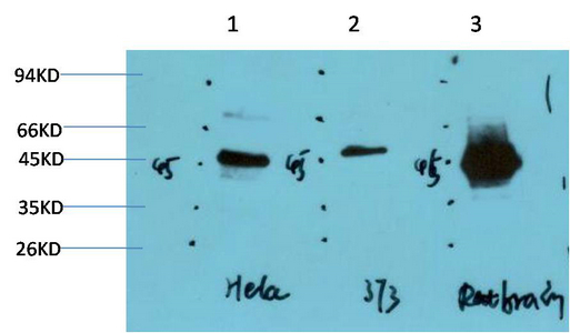 GSK3β Mouse Monoclonal Antibody(2C6)