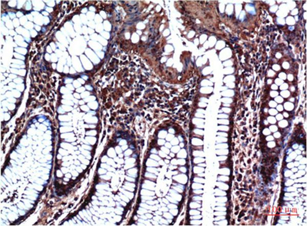 GSK3β Mouse Monoclonal Antibody(4D2)