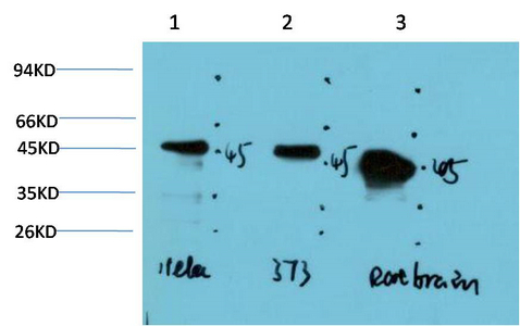 GSK3β Mouse Monoclonal Antibody(4D2)