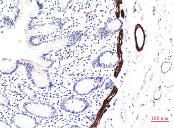 Muscle actin Mouse Monoclonal Antibody(1E9)