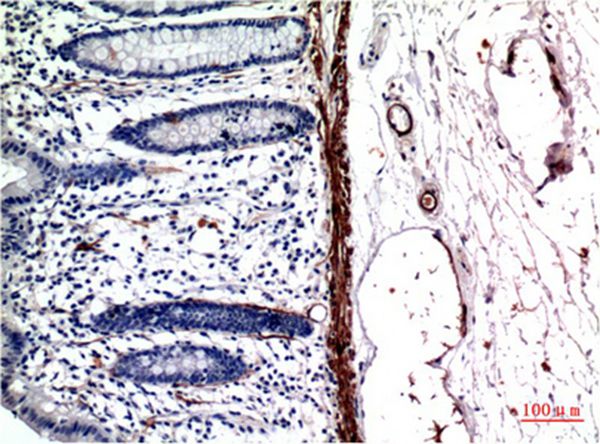 Muscle actin Mouse Monoclonal Antibody(4G10)