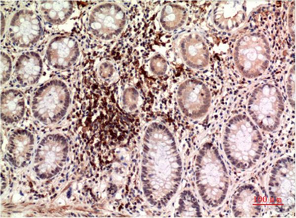 Epsilon Tubulin Mouse Monoclonal Antibody(3G1)