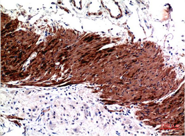 Muscle actin Mouse Monoclonal Antibody(3E9)