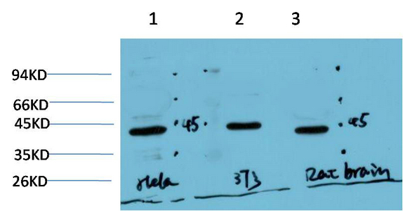 Muscle actin Mouse Monoclonal Antibody(3E9)