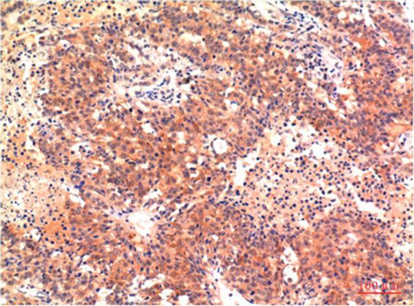 LC3A Mouse Monoclonal Antibody(5G10)