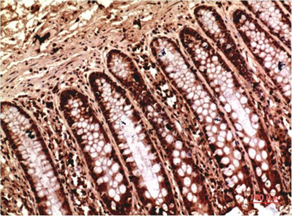 Gamma Tubulin Mouse Monoclonal Antibody(7B1)