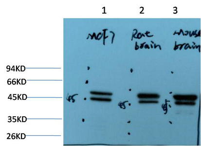 Epsilon Tubulin Mouse Monoclonal Antibody(2B3)