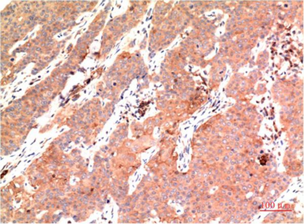 Epsilon Tubulin Mouse Monoclonal Antibody(3C1)