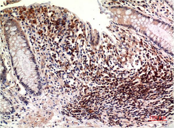 Epsilon Tubulin Mouse Monoclonal Antibody(3C1)