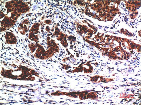 AKT Mouse Monoclonal Antibody(1E11)