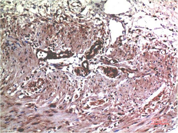 MMP2 Mouse Monoclonal Antibody(1H1)