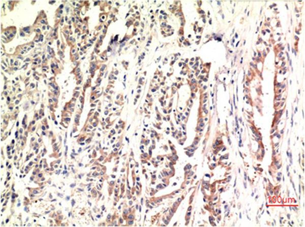 CHOP Mouse Monoclonal Antibody(2B1)