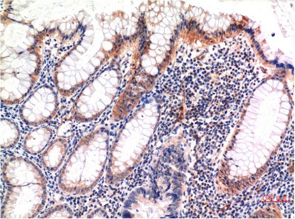 phospho-MLKL (S358) Mouse Monoclonal Antibody(6F8)