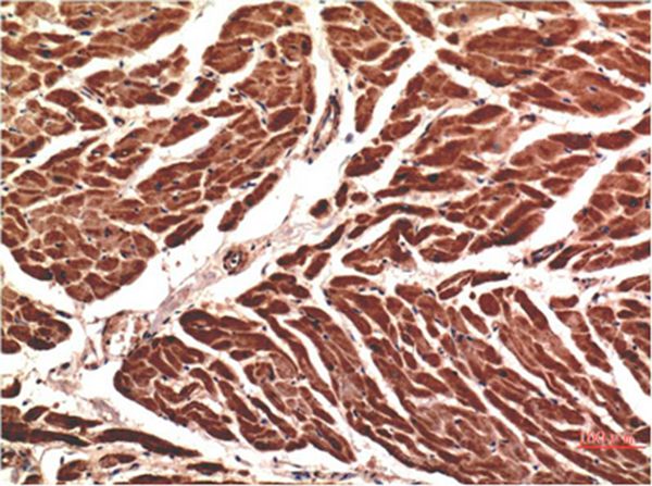 VE-Cadherin Mouse Monoclonal Antibody(8E5)