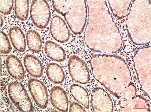 ATM Mouse Monoclonal Antibody(4G9)