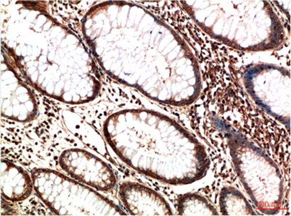 ATM Mouse Monoclonal Antibody(3D3)