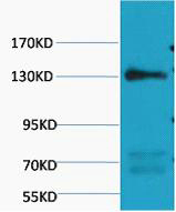 eNOS Monoclonal Antibody(Mix)