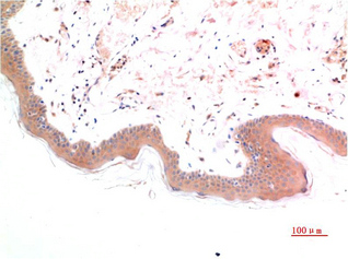 Phospho-Smad3(S425) Mouse Monoclonal Antibody(1D9)