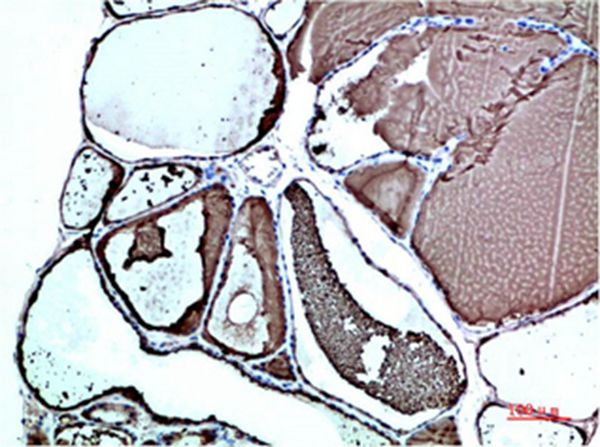 TTR Mouse Monoclonal Antibody(1D7)