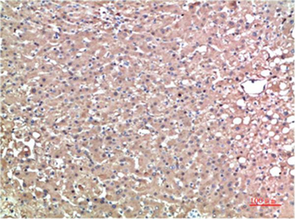 TTR Mouse Monoclonal Antibody(1D7)