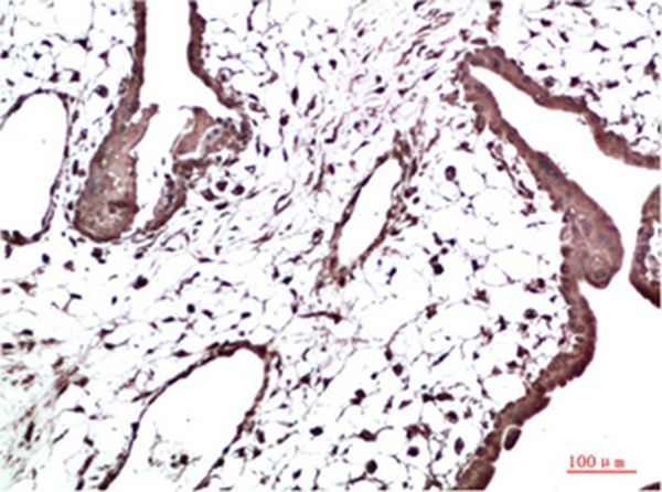 HP-1γ Mouse Monoclonal Antibody(2F5)