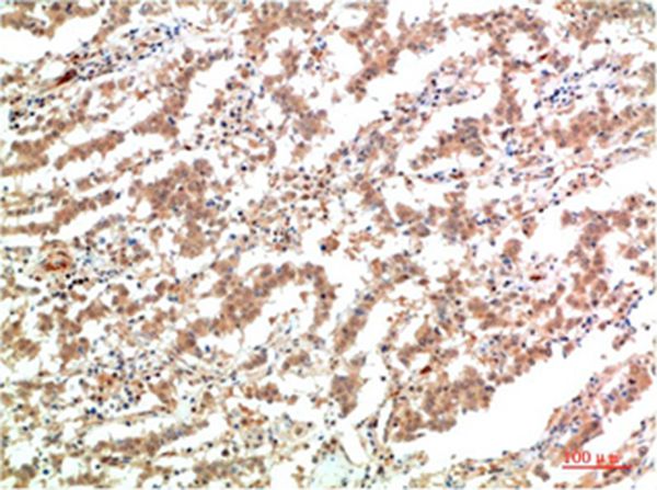 JAK2 Mouse Monoclonal Antibody(3F10) 