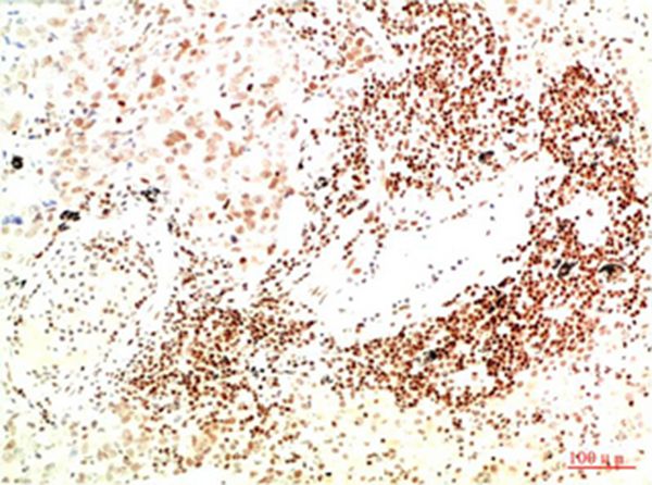 JAK2 Mouse Monoclonal Antibody(9B4) 