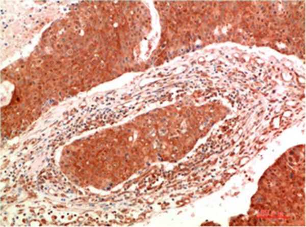 JAK2 Mouse Monoclonal Antibody(9B4) 