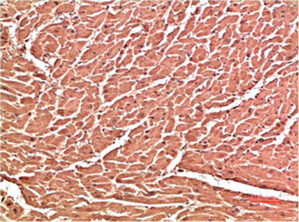 VE-Cadherin Mouse Monoclonal Antibody(3G8)