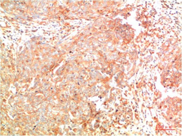 ATG7 Mouse Monoclonal Antibody(3D6)