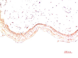 Collagen I Mouse Monoclonal Antibody(4B5)