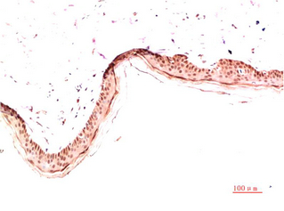 Collagen I Mouse Monoclonal Antibody(5B7)